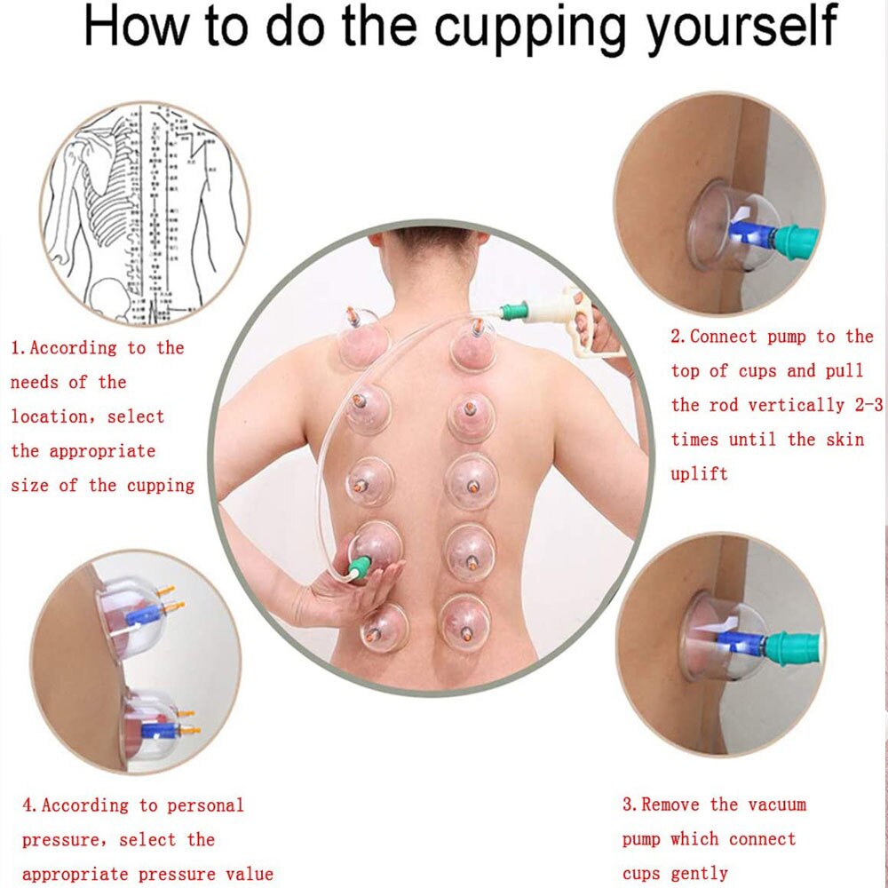 Tasses de thérapie cupping en silicone lot de 12