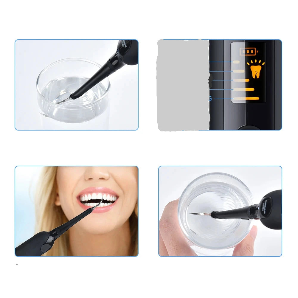 FreshWhite™ – Waterproof Electric Dental Scaler with 6 Speeds