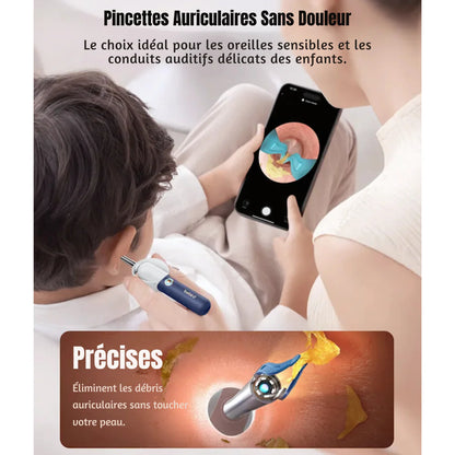 Bebird EarSight Plus Ear Cleaner