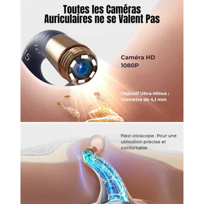 Bebird EarSight Plus Ear Cleaner