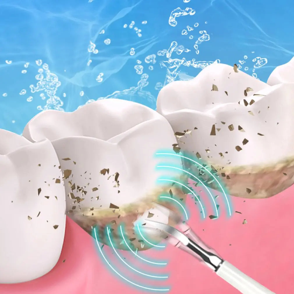 SparkSonic™ – Sonic Dental Tartar Remover with Integrated Irrigation